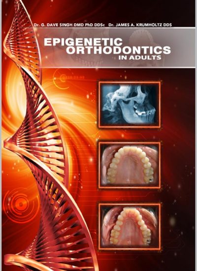 Epigenetic Orthodontics in Adults Ebook cover